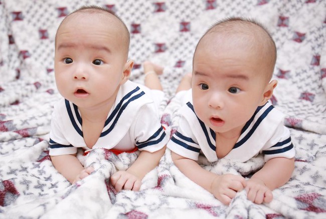 Cặp song sinh nhà Đào Thị Huyền lúc còn nhỏ Cặp song sinh nhà Đào Thị Huyền lúc còn nhỏ