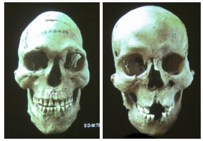 Những "người lạ" trong văn hóa Đông Sơn (kỳ 1): Từ những bộ hài cốt khác biệt - Ảnh 2.