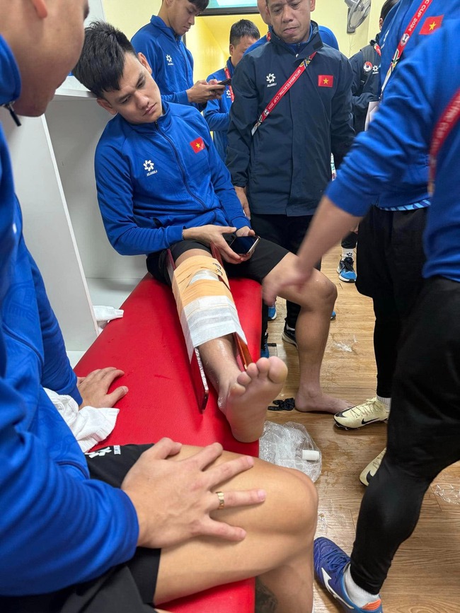 HLV Kim Sang Sik đổ gục xuống sân sau tình huống Tấn Tài dính chấn thương nặng - Ảnh 2. HLV Kim Sang Sik đổ gục xuống sân sau tình huống Tấn Tài dính chấn thương nặng - Ảnh 2.